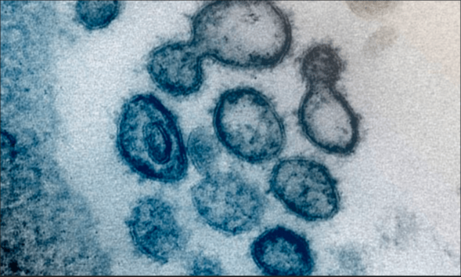 Screen Shot 2020-03-18 at 10.33.30 PM